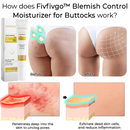 Hidratante Fivfivgo™ Blemish Control