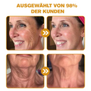 Furzero™ Botox Bee Venom