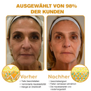 Furzero™ Botox Bee Venom
