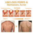 GFOUK™ SKINSOLVE
