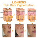 GFOUK™ SKINSOLVE