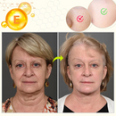 RevitaBoost- Soro Facial
