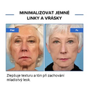Soro Facial Botulínico