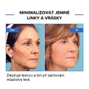 Soro Facial Botulínico