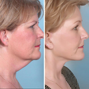 Fivfivgo™ UltraRenew