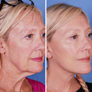 Fivfivgo™ UltraRenew