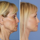 Fivfivgo™ UltraRenew